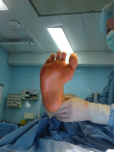 stopa końsko-sztopawwa 2